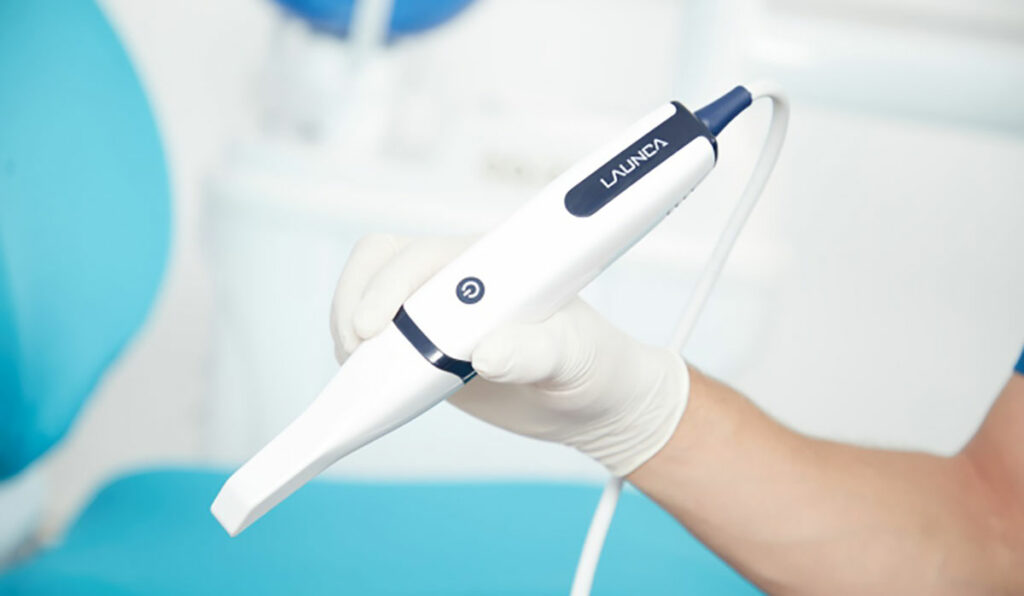 Hand mit Intraoralscanner