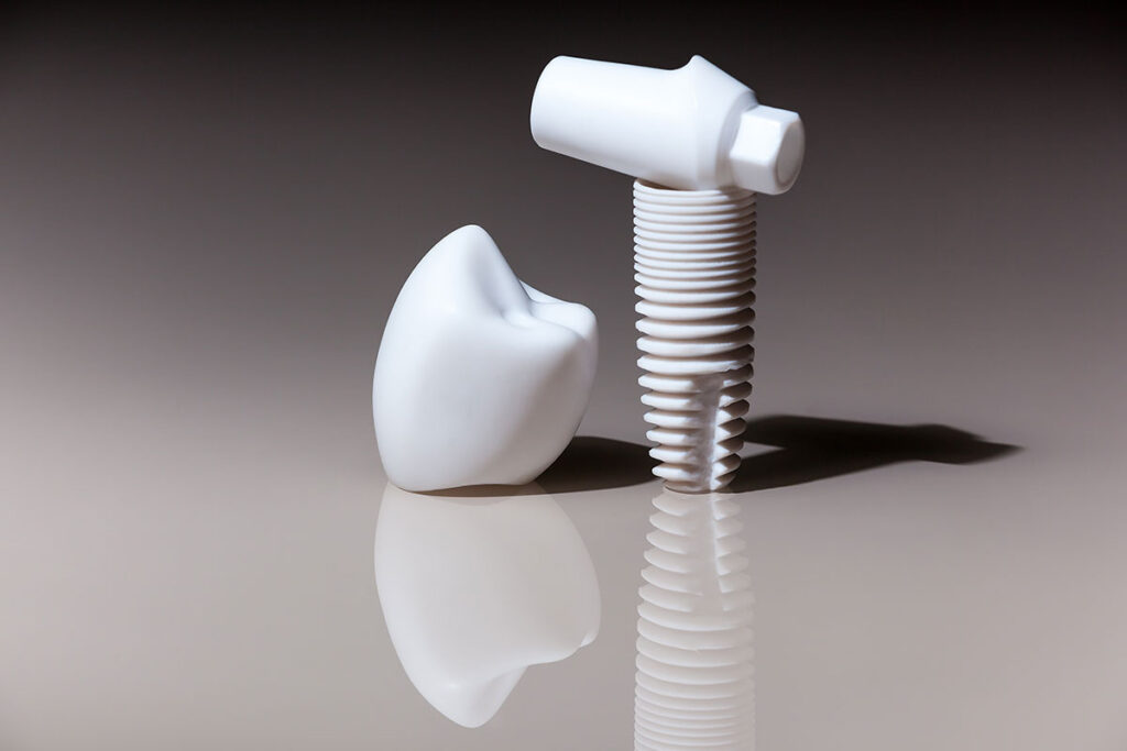 Keramikimplantat